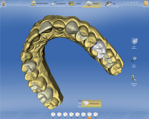 cerec 3D teeth model